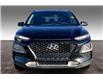 2020 Hyundai Kona 2.0L Preferred (Stk: 23A00452) in Sherwood Park - Image 3 of 30 2020 Hyundai Kona 2.0L Preferred (Stk: 23A00452) in Sherwood Park - Image 3 of 30