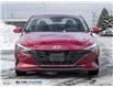 2021 Hyundai Elantra Preferred (Stk: 104379) in Milton - Image 2 of 23