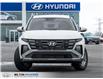 2026 Hyundai Tucson Preferred (Stk: 035120) in Milton - Image 2 of 8