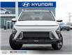 2026 Hyundai Kona Preferred (Stk: 406690) in Milton - Image 2 of 26