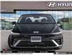 2026 Hyundai Elantra N-Line Ultimate (Stk: U125538) in Brooklin - Image 2 of 23
