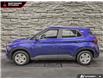 2024 Hyundai Venue ESSENTIAL (Stk: 320931) in North Vancouver - Image 3 of 22