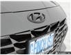 2022 Hyundai Elantra Ultimate (Stk: 104894) in London - Image 9 of 26