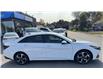 2022 Hyundai Elantra  (Stk: 251124) in Ottawa - Image 4 of 24