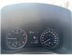 2017 Hyundai Elantra GLS (Stk: S26101A) in Newmarket - Image 17 of 17 2017 Hyundai Elantra GLS (Stk: S26101A) in Newmarket - Image 17 of 17