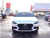 2019 Hyundai Elantra GT N Line Ultimate (Stk: 22U3872A) in Mississauga - Image 8 of 30