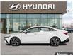 2026 Hyundai Elantra Luxury (Stk: 132160) in London - Image 3 of 25