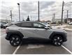 2024 Hyundai Kona 2.0L Preferred (Stk: 12170P) in Scarborough - Image 6 of 18