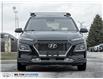 2020 Hyundai Kona 1.6T Ultimate (Stk: 422676) in Milton - Image 2 of 26
