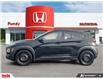 2018 Hyundai Kona 2.0L Luxury (Stk: N205229A) in Saint John - Image 2 of 28