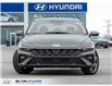 2026 Hyundai Elantra Luxury (Stk: 133189) in Milton - Image 2 of 27