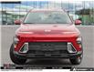 2026 Hyundai Kona 2.0L Preferred w/Trend Package (Stk: U417691) in Brooklin - Image 2 of 25