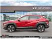 2026 Hyundai Kona 2.0L Preferred w/Trend Package (Stk: U417720) in Brooklin - Image 3 of 25