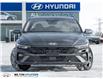 2025 Hyundai Elantra Luxury (Stk: 887181) in Milton - Image 2 of 28