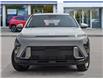 2026 Hyundai Kona 2.0L Essential (Stk: 261979) in Aurora - Image 2 of 23