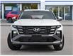 2026 Hyundai Tucson Preferred (Stk: 261988) in Aurora - Image 2 of 23