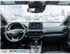 2022 Hyundai Kona 1.6T N Line (Stk: 863666) in Milton - Image 23 of 24