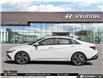 2026 Hyundai Elantra Preferred w/Tech Package (Stk: U150091) in Brooklin - Image 3 of 26