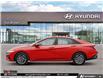 2026 Hyundai Elantra Preferred (Stk: U133687) in Brooklin - Image 3 of 23