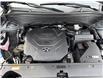 2024 Hyundai Palisade Ultimate Calligraphy (Stk: 35939A) in Scarborough - Image 26 of 33