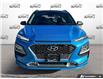 2020 Hyundai Kona 1.6T Trend w/Two-Tone Roof (Stk: P221085A) in Grimsby - Image 3 of 23