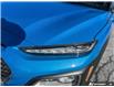 2020 Hyundai Kona 1.6T Trend w/Two-Tone Roof (Stk: P221085A) in Grimsby - Image 9 of 23