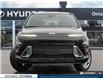 2026 Hyundai Kona 2.0L Essential (Stk: 7-1670) in Whitby - Image 2 of 26