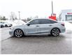 2025 Honda Civic Hybrid Sport Touring (Stk: B2380) in Ottawa - Image 4 of 4