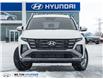 2026 Hyundai Tucson Preferred (Stk: 038720) in Milton - Image 2 of 22