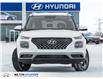 2026 Hyundai Venue Ultimate w/Black Interior (IVT) (Stk: 448791) in Milton - Image 2 of 24
