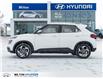 2026 Hyundai Venue Ultimate w/Black Interior (IVT) (Stk: 448791) in Milton - Image 3 of 24