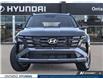 2026 Hyundai Tucson Preferred (Stk: 7-1688) in Whitby - Image 2 of 26