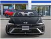 2026 Hyundai Elantra N-Line Ultimate (Stk: 262042) in Aurora - Image 2 of 21
