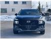 2022 Hyundai Santa Fe Urban (Stk: 26P021) in Kingston - Image 2 of 17