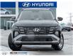 2026 Hyundai Tucson Preferred (Stk: 038115) in Milton - Image 2 of 23