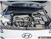 2022 Hyundai Kona 2.0L Essential (Stk: 106401) in London - Image 8 of 24 2022 Hyundai Kona 2.0L Essential (Stk: 106401) in London - Image 8 of 24