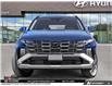 2026 Hyundai Tucson Hybrid Ultimate (Stk: U457804) in Brooklin - Image 2 of 23