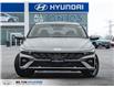 2026 Hyundai Elantra HEV Luxury (Stk: 195362) in Milton - Image 2 of 29