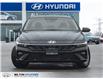 2026 Hyundai Elantra ESSENTIAL (Stk: 141576) in Milton - Image 2 of 23