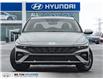 2026 Hyundai Elantra Preferred (Stk: 164358) in Milton - Image 2 of 23