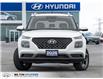 2026 Hyundai Venue Ultimate w/Black Interior (IVT) (Stk: 448791) in Milton - Image 2 of 24