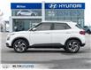 2026 Hyundai Venue Ultimate w/Black Interior (IVT) (Stk: 448791) in Milton - Image 3 of 24