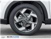 2026 Hyundai Venue Ultimate w/Black Interior (IVT) (Stk: 448791) in Milton - Image 4 of 24