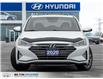 2020 Hyundai Elantra Luxury (Stk: 970673) in Milton - Image 2 of 24