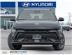 2026 Hyundai Kona 1.6T N Line Ultimate (Stk: 410513) in Milton - Image 2 of 31