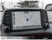 2021 Hyundai Kona 1.6T Ultimate w/Red Colour Pack (Stk: 704634) in Milton - Image 12 of 26