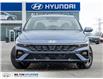 2026 Hyundai Elantra HEV Luxury (Stk: 198725) in Milton - Image 2 of 25