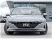2021 Hyundai Elantra  (Stk: 15105489AA) in Richmond Hill - Image 3 of 23