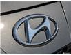 2022 Hyundai Elantra Ultimate w/Two-Tone Interior (Stk: 121294) in London - Image 9 of 19