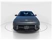 2024 Hyundai Kona 2.0L Essential (Stk: 16104808A) in Markham - Image 3 of 13